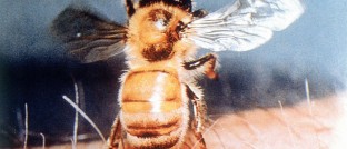 Puntura d'ape su una persona